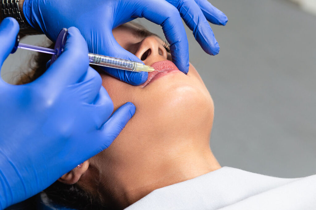 A patient receiving lip enhancement with dermal fillers.