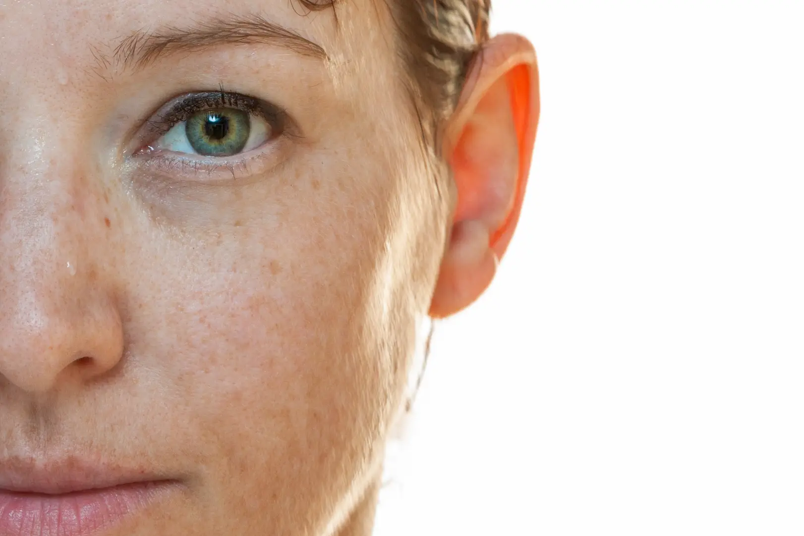 Close-up of a face showing visible freckles, pigmentation, and skin texture.