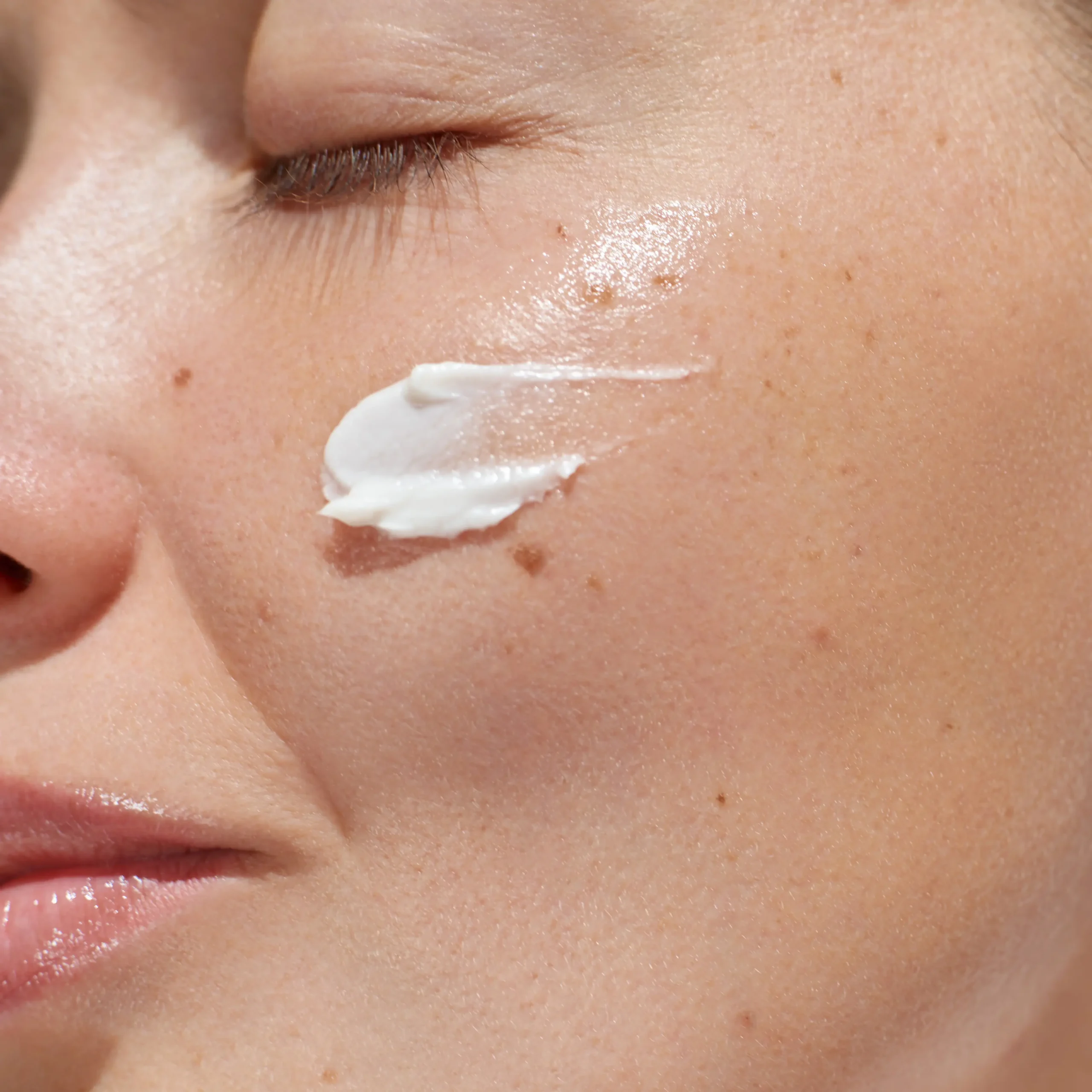 Close-up of skincare cream applied beneath a person's eye on the upper cheek.